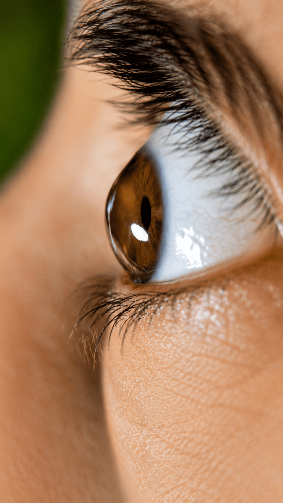 Refractive Surgery